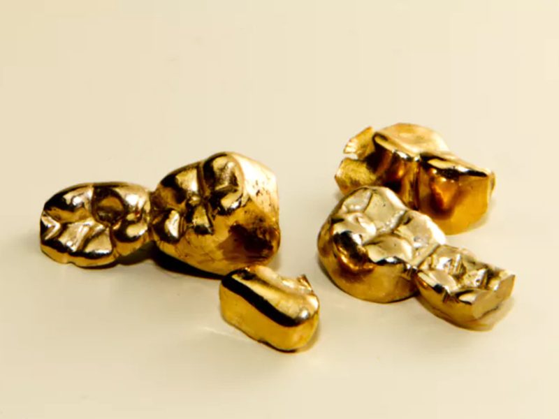 degussa-altgoldkampagne-zahngold degussa-altgoldkampagne-zahngold